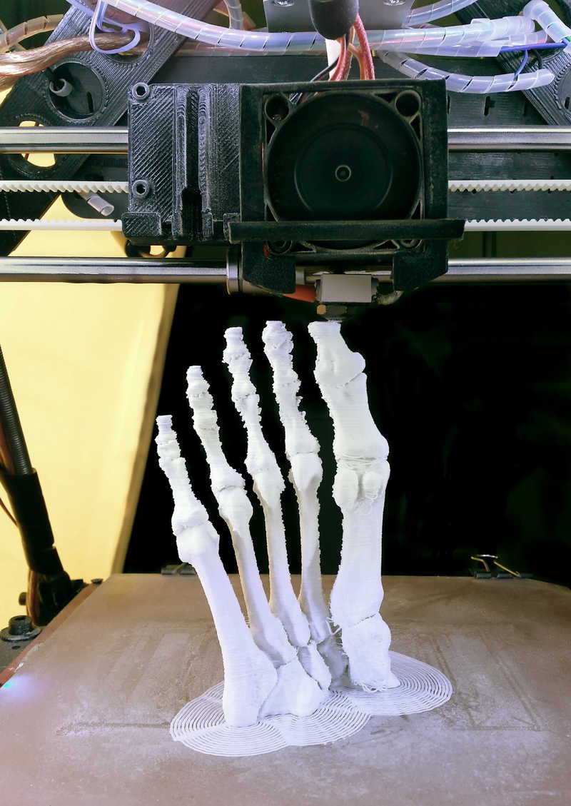 Как 3D-печать преобразила сферу медицины за последние годы - 2
